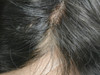 Invisible French Lace Toupee