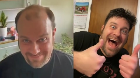 Toupee Before and After